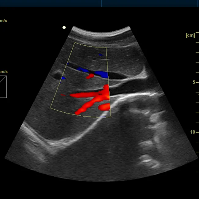 
15' LED Color ultrasound scanner Portable Digital Ultrasonic Color Diagnostic Imaging System 