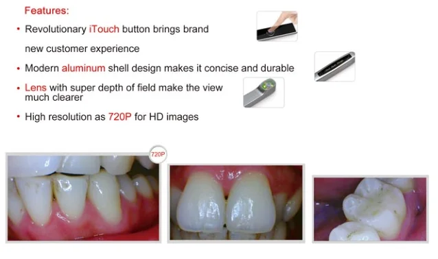 Wireless best dental intraoral camera Dental equipment APPLEDENTAL