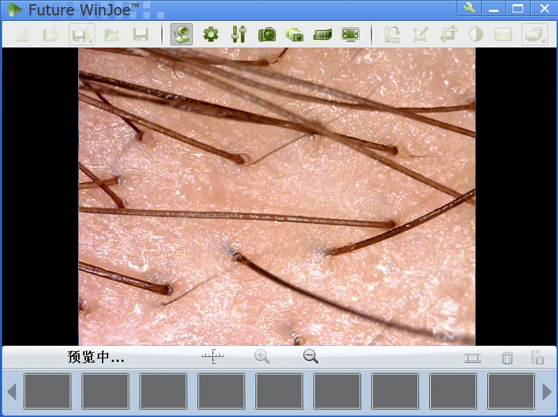 Patent portable USB digital skin microscope for skin analyze