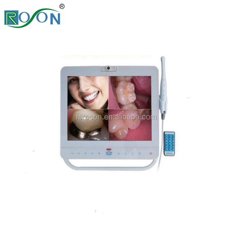 dental intraoral camera with 15 inch monitor price for teeth x ray