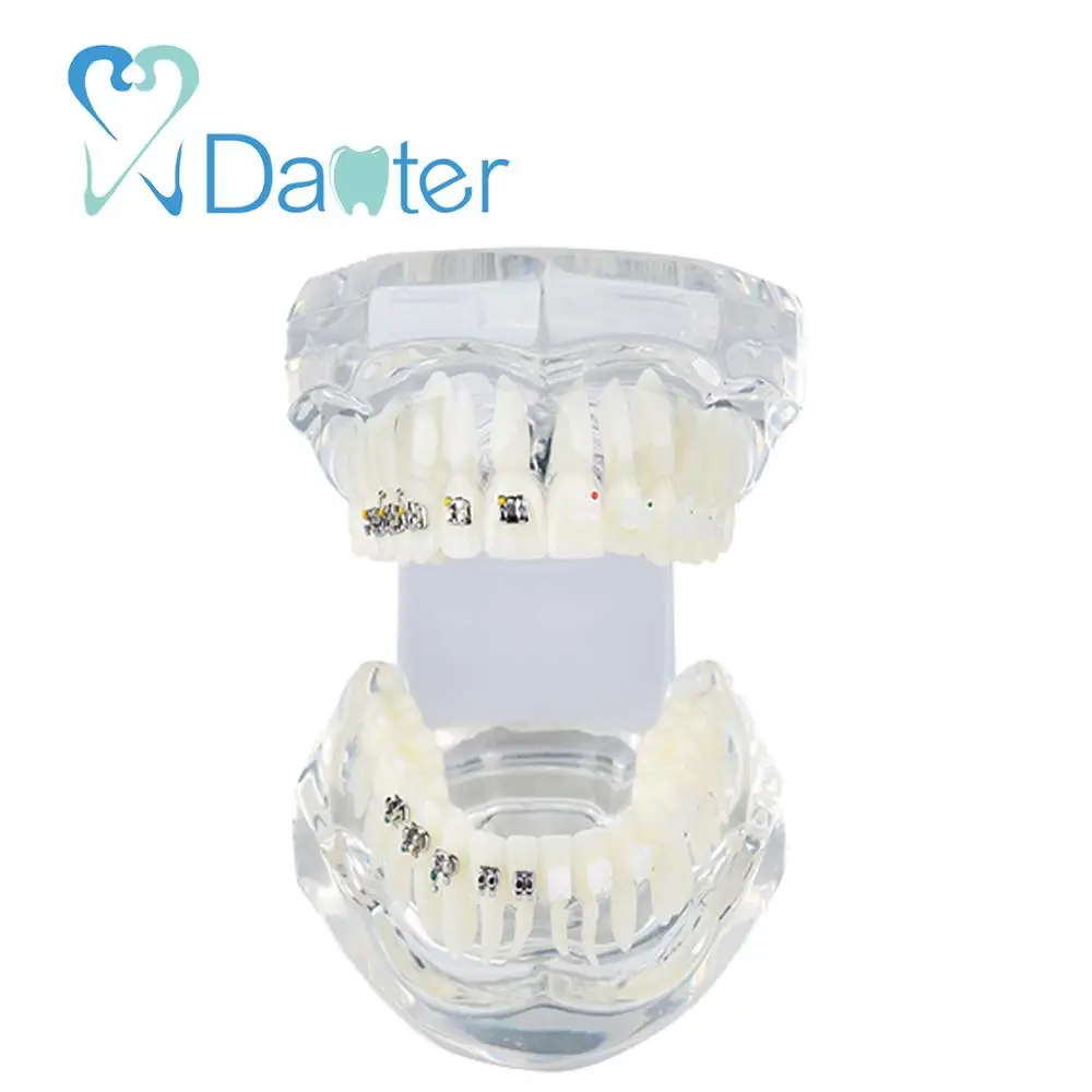 New Arrival Dental Orthodontic Model with Metal and Ceramic Bracket