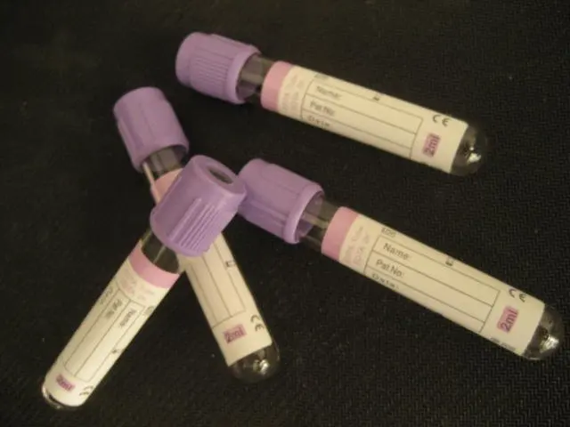 4 мл EDTA вакуумная трубка для определения крови