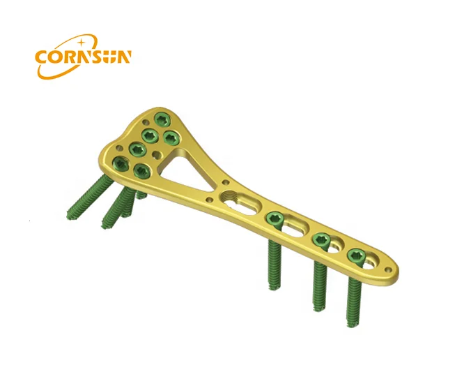 Ортопедические имплантаты Дистальный радиус многоосевая фиксирующая пластина титановый радиус фиксация