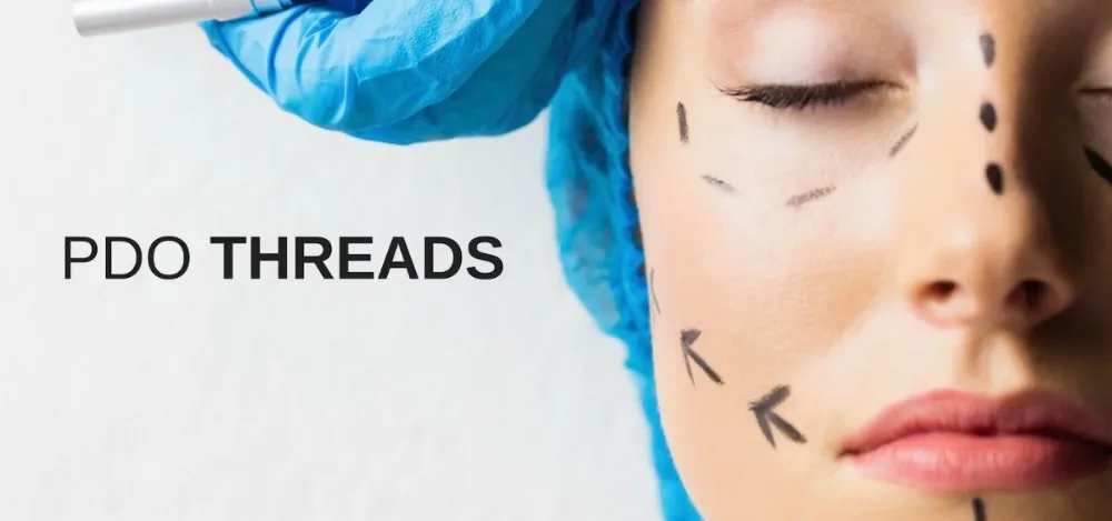 New Innovative Products URWAY PDO PCL threads price thread lift procedure