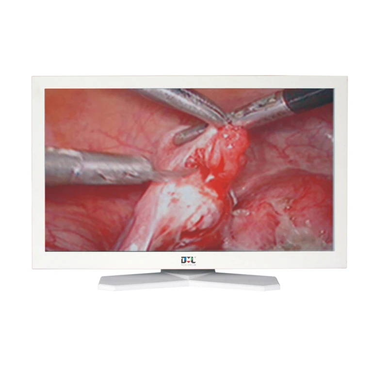 
2020 hotsale cheap Medical Touch Screen Monitor 