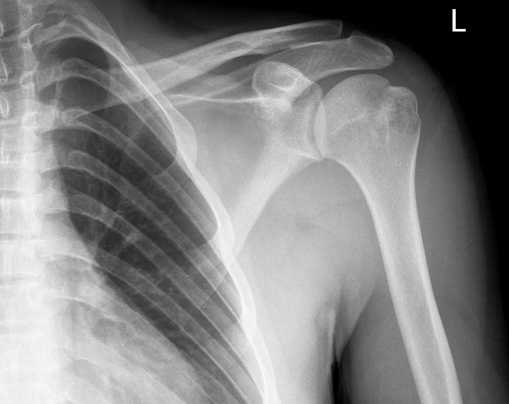 Agfa x-ray film 14*17 / Konica Sdq Dry Laser Medical X-Ray Film Sd-Q