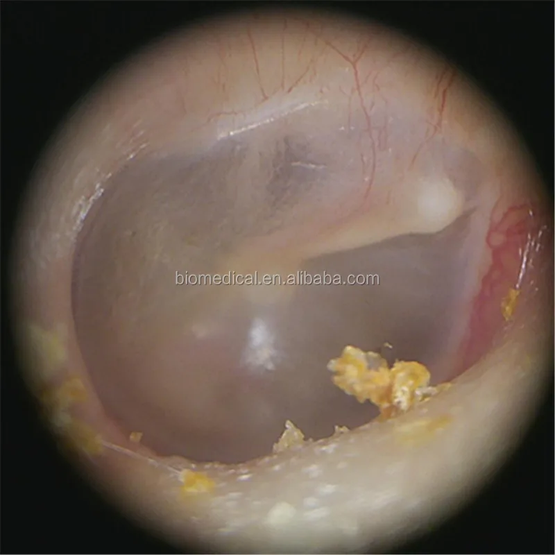 3.5 inch Color Screen Otoscope Endoscope Parts Handheld ENT Inspection Equipment With CE Certificate