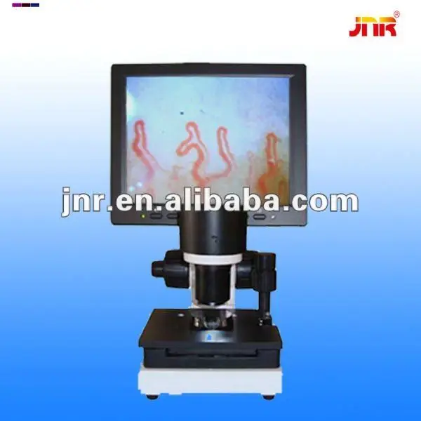 clinical capillaroscopy