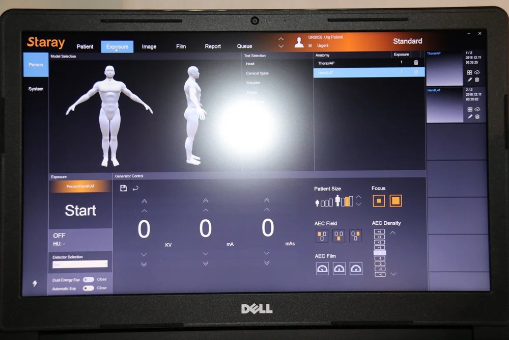 radiology flat panel digital portable x-ray machine