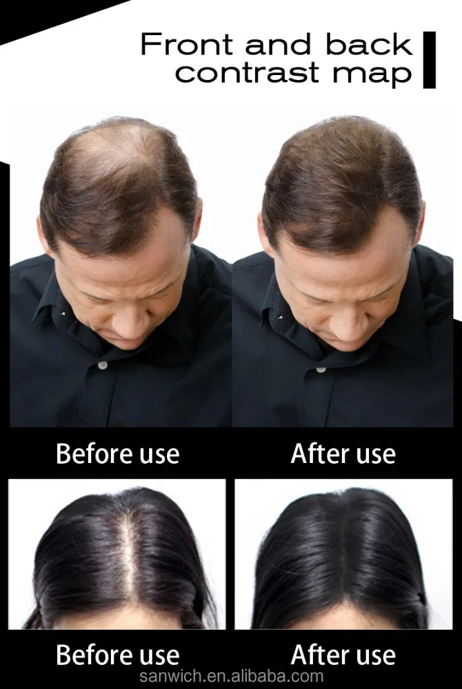 Private Label Keratin Black Powder Hair Building Fiber Refill Powder 100G