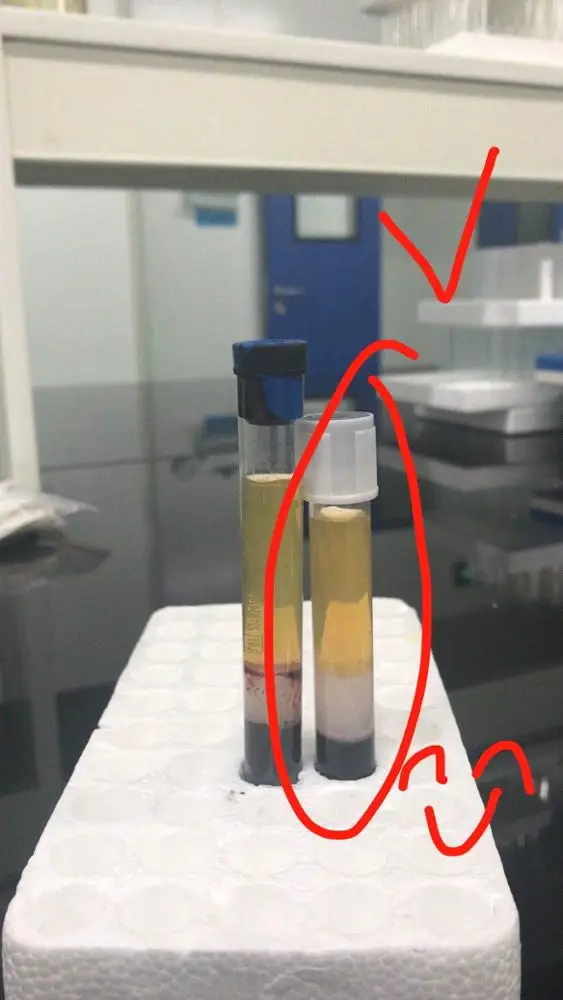 
CE/OEM/Vaccum blood collection tube /prp tube with acd gel/prp kit 