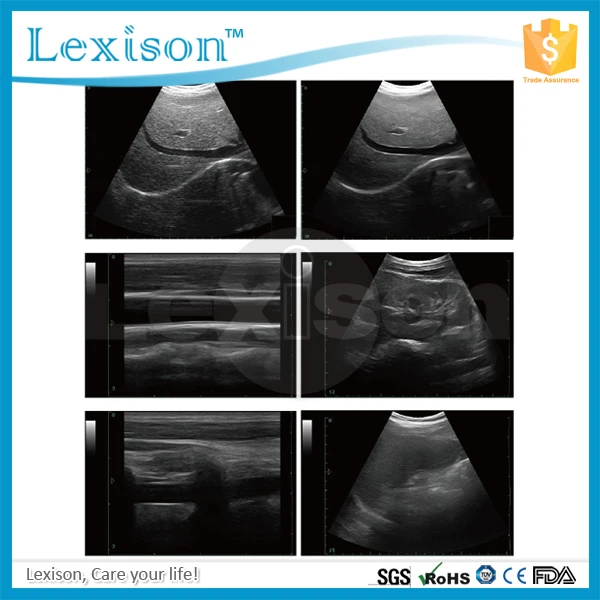 
Cheapest portable ultrasound machine&high resolution ultrasound scanner 