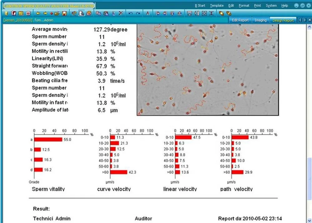 Компьютерный Анализатор Спермы-CASA