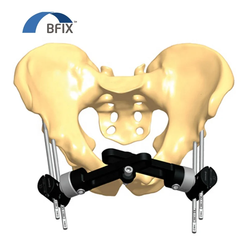
Bfix Pelvic T-Clamps, Anterior application of the Pelvic Fixator Short Body 