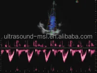 High Sensitive Vivid image Trolly Color doppler ultrasound Sonoscape S20 with probes and tranducers