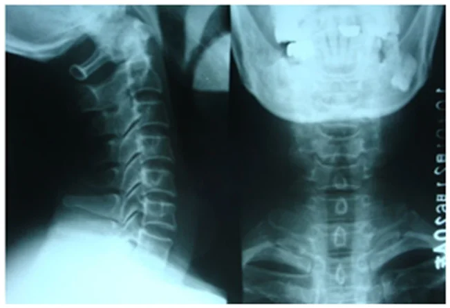 Пленки Agfa agfa drystar фильм dt2b agfa dt2b фильм, fuji drypix lite сухой пленки