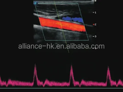 Sonoscape S12 4D Cart Color Doppler Human Ultrasound For Gynecology,Cardiovascular 15inch  LED monitor