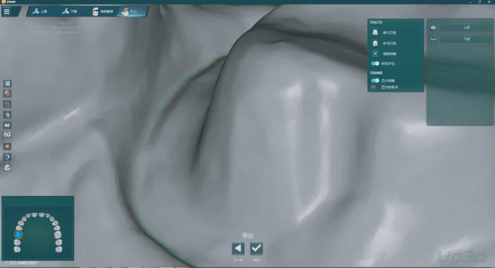 Портативный стоматологический сканер Demetdent SC360T, синий свет, 3D сканер