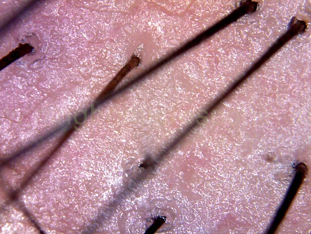 CE FCC ROHS Digital Usb Microscope for Skin Inspection