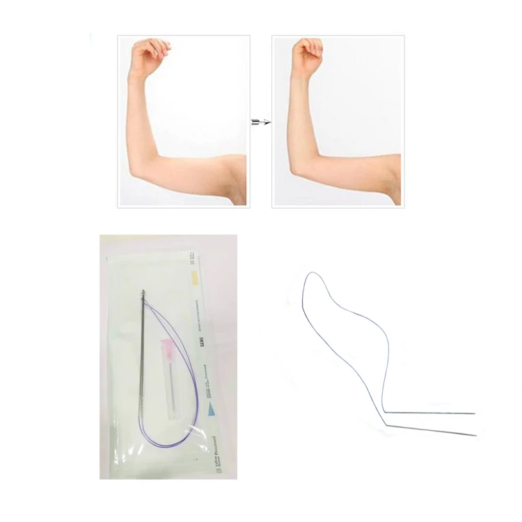 Disposable cosmetic pdo thread lift double needle 4D cog