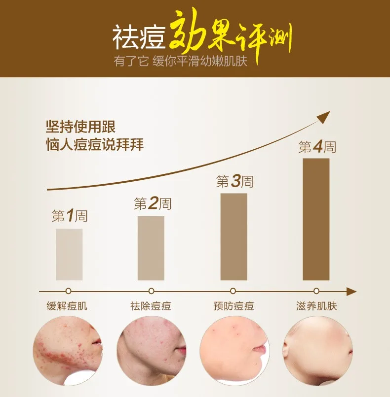 professional cosmetics factory OEM safe effective herbal pimples acne removal scar fading cream