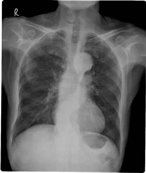 Fuji drypix lite 3000, agfa качеством dt2b, рентгеновской agfa качеством dt2b пленки цена