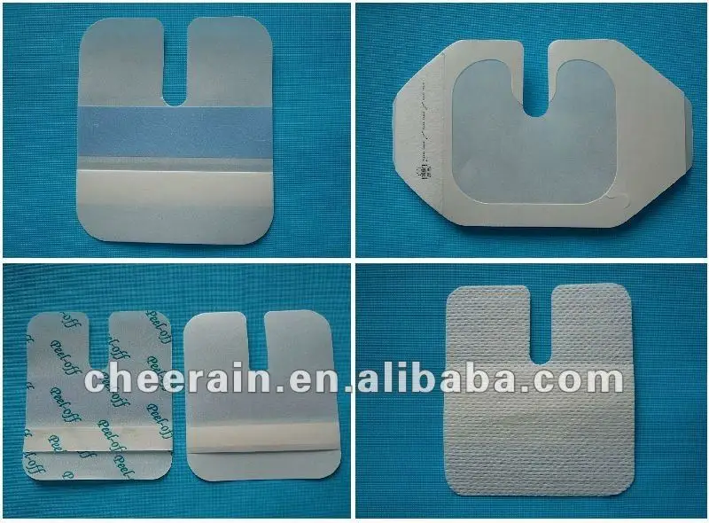 medical adhesive tape Medical Dressing -Incise film Medical dressing in health and medical line