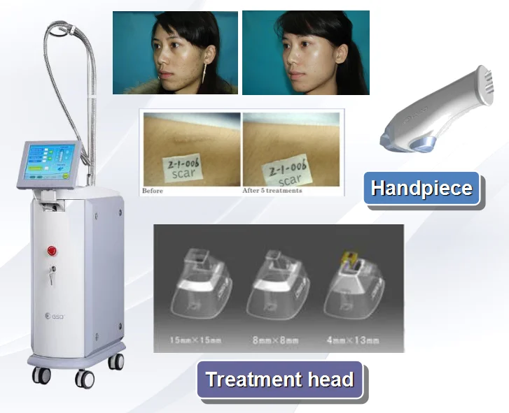 GSD 1550nm лазерная машина для удаления морщин/удаление морщин устройство с медицинской сертификат CE