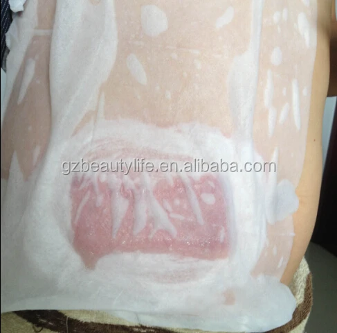 Cryo pad anti freeze antifreeze membrane