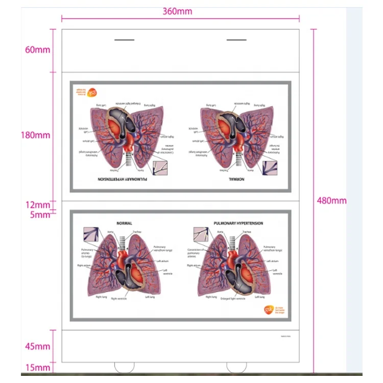 Human organ Medical chart 3d embossed lung wall chart