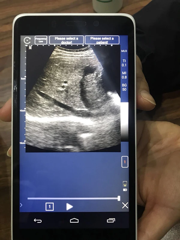 TOP-A1025 portable 4d color doppler ultrasound scanner system usb