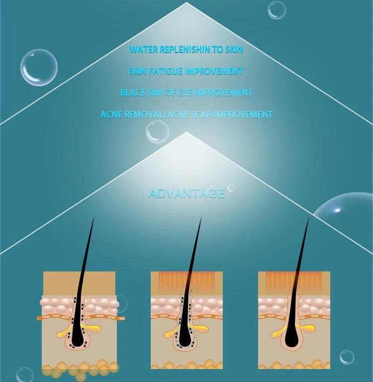 5 in1 oxygen aqua jet peel water microdermabrasion facial machine