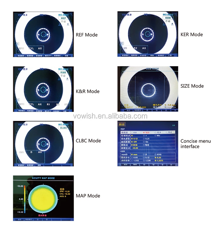 auto refractor keratometer