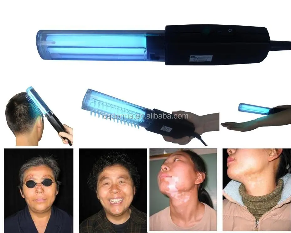 UVB Phototherapy Lamps UV Photoherapy Light Lampp 311nm Narrowband for Home Use  For Psoriasis Vitiligo Treatment