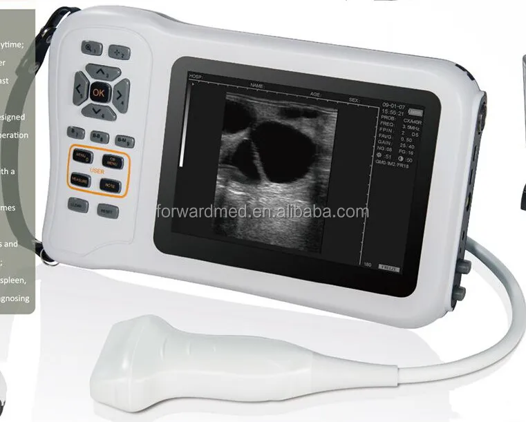 Portable Ultrasonic Diagnostic Devices Type Laptop ultrasound scanner/ usb ultrasound probe for laptop