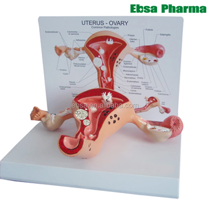 
Advanced Medical Supplies Human Teaching Anatomical Uterus Model 