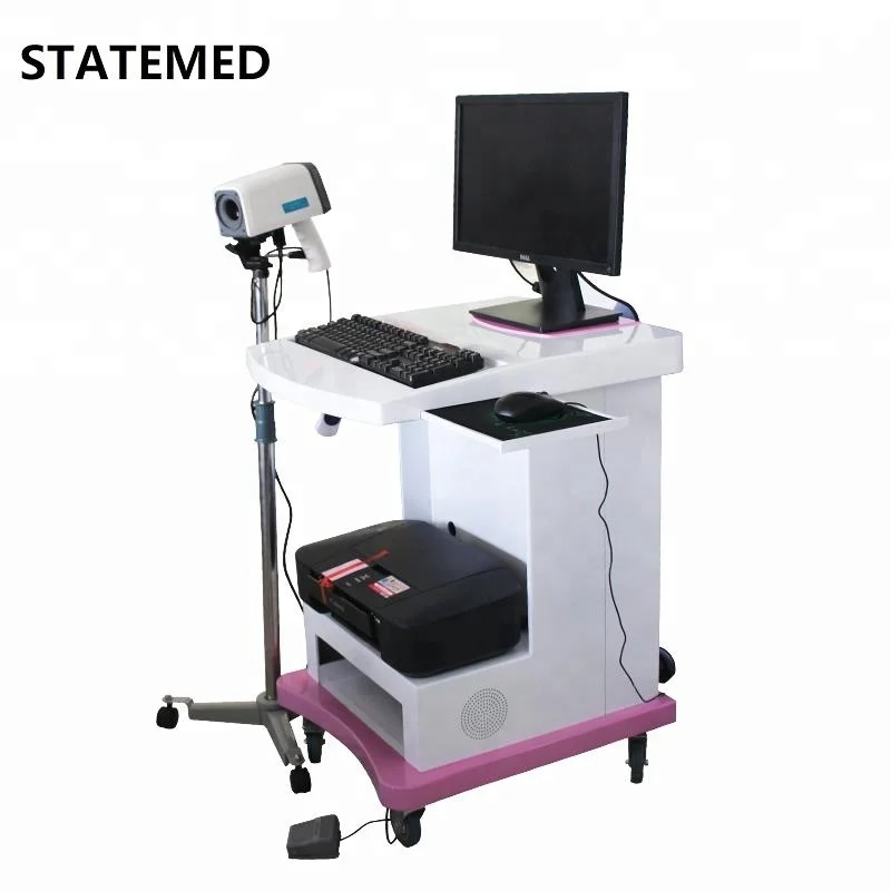 Hot selling mini digital colposcope for gynecology