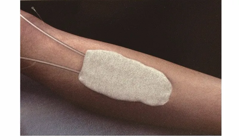 
Disposable Negative Pressure Wound Therapy NPWT Foam Dressing Kits/ VAC with CE,ISO 