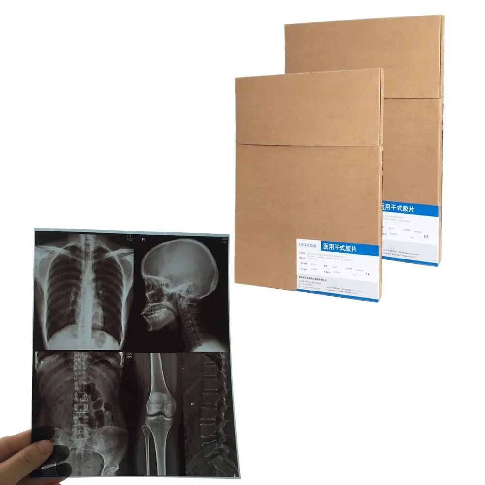 Thermal medical X-ray film for mri/cr/ct scan