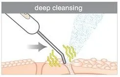 OEM scrubber Home Use Facial Exfoliator Ultrasound Neck Massager Skin Scrubber