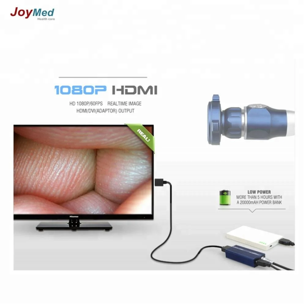 new  exclusively endoscope camera for vets