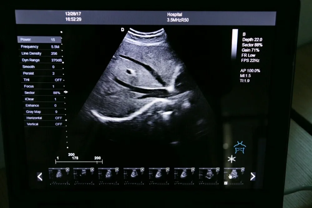 hot selling 2021 style Design latest cardio color doppler & portable doppler ultrasound machine with certificate