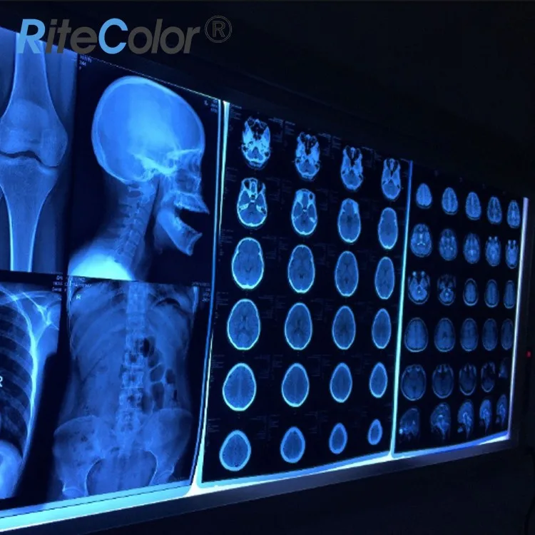 China OEM 210um Medical Blue Base X Ray Film in 8x10 14x17 Sheets