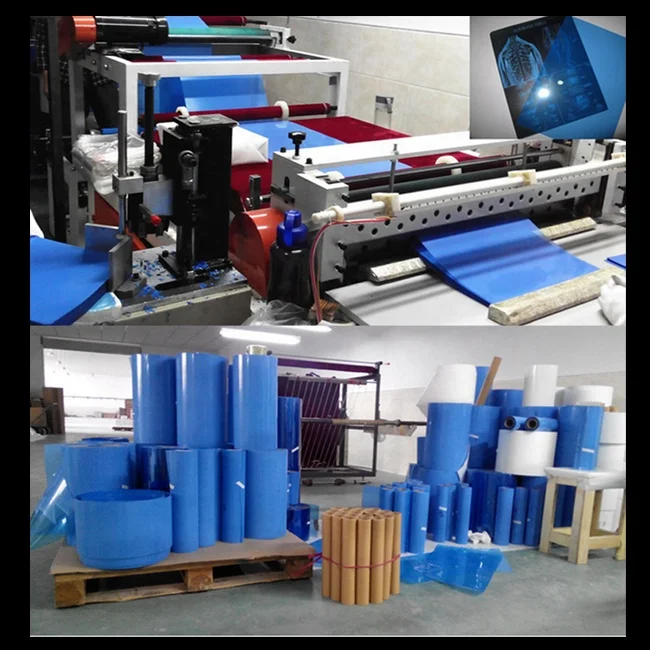 Medical X Ray Blue Film Roll Packing High Definition Inkjet Blue Film for Hospital Healthcare Waterproof