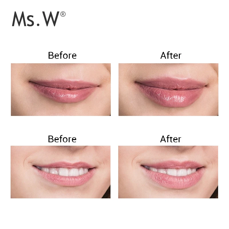  Home use Skin Unique Lip Plumper Electric Device Natural Suction Full Lips Tool For Personal
