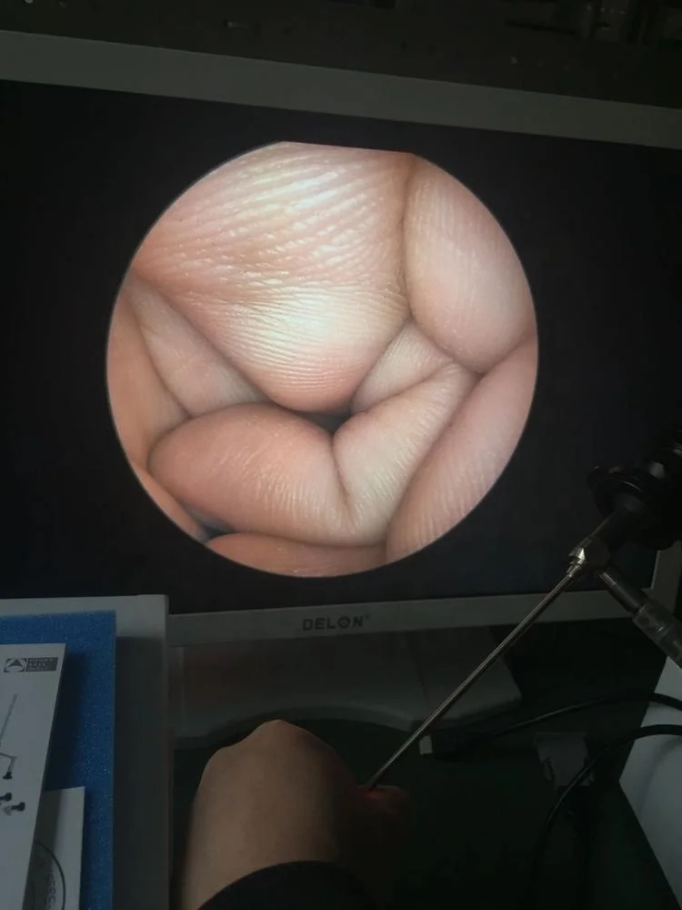 
DELON 1080P FULL HD portable camera/endoscopy 