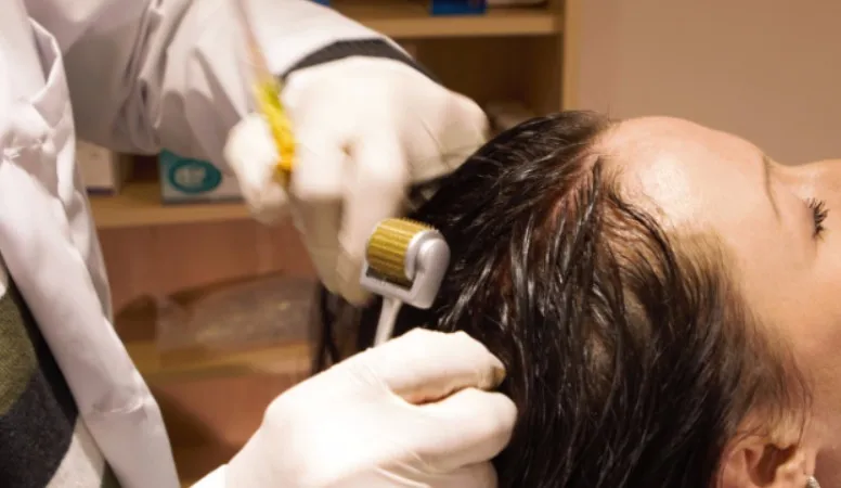 
Hair Loss Treatment Otesaly Mesotherapy Solution Serum for Hair Growth 