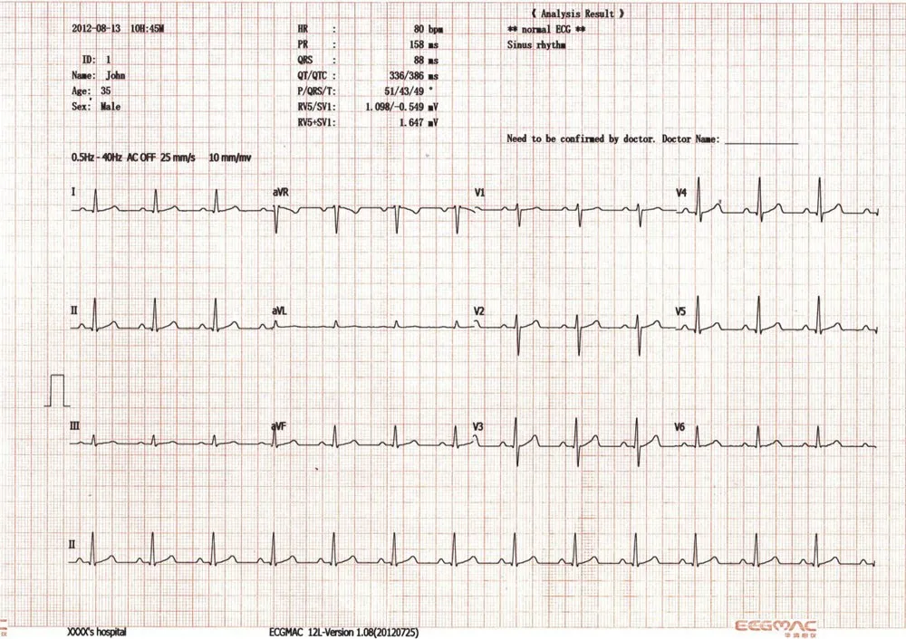 
PC based ECG Windows PC ECG mini ECG 