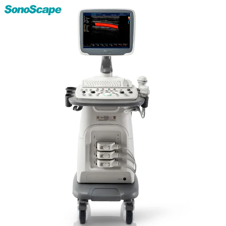 SonoScape S11 Color Doppler Diagnostic Ultrasonic Medical Equipment