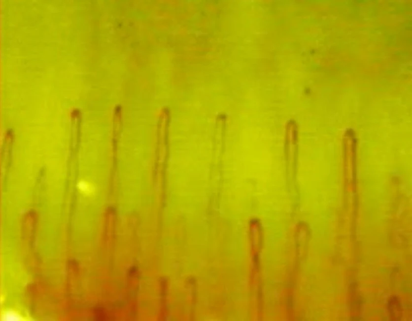 LCD Screen Digital Capillary Microcirculation Microscope